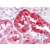Human Kidney: Formalin-Fixed, Paraffin-Embedded (FFPE)