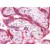 Human Placenta: Formalin-Fixed, Paraffin-Embedded (FFPE)