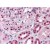Human Kidney: Formalin-Fixed, Paraffin-Embedded (FFPE)