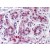 Human Breast: Formalin-Fixed, Paraffin-Embedded (FFPE)