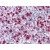 Human Spleen: Formalin-Fixed, Paraffin-Embedded (FFPE)