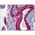 Human Lung, Vessels: Formalin-Fixed, Paraffin-Embedded (FFPE)