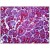 Human Pancreas: Formalin-Fixed, Paraffin-Embedded (FFPE)