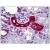 Human Kidney: Formalin-Fixed, Paraffin-Embedded (FFPE)