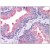 Human Prostate: Formalin-Fixed, Paraffin-Embedded (FFPE)