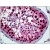 Human Testis: Formalin-Fixed, Paraffin-Embedded (FFPE)