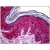 Human Skin: Formalin-Fixed, Paraffin-Embedded (FFPE)
