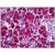 Human Pancreas: Formalin-Fixed, Paraffin-Embedded (FFPE)