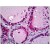 Human Thyroid: Formalin-Fixed, Paraffin-Embedded (FFPE)
