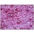 Human Brain, Cortex: Formalin-Fixed, Paraffin-Embedded (FFPE)