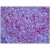 Human Tonsil: Formalin-Fixed, Paraffin-Embedded (FFPE)