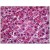 Human Liver: Formalin-Fixed, Paraffin-Embedded (FFPE)