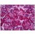 Human Pancreas: Formalin-Fixed, Paraffin-Embedded (FFPE)