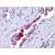 Human Pancreas, Duct: Formalin-Fixed, Paraffin-Embedded (FFPE)