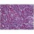 Human Pancreas: Formalin-Fixed, Paraffin-Embedded (FFPE)