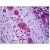 Human Intestine, Ganglion Cells: Formalin-Fixed, Paraffin-Embedded (FFPE)