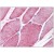 Human Skeletal Muscle: Formalin-Fixed, Paraffin-Embedded (FFPE)