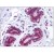 Human Breast: Formalin-Fixed, Paraffin-Embedded (FFPE)
