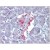 Human Pancreas: Formalin-Fixed, Paraffin-Embedded (FFPE)