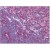 Human Thymus: Formalin-Fixed, Paraffin-Embedded (FFPE)