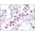 Human Lung: Formalin-Fixed, Paraffin-Embedded (FFPE)