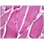 Human Skeletal Muscle: Formalin-Fixed, Paraffin-Embedded (FFPE)