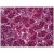 Human Adrenal Cortex: Formalin-Fixed, Paraffin-Embedded (FFPE)