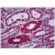Human Kidney, Tubules: Formalin-Fixed, Paraffin-Embedded (FFPE)