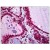 Human Thyroid: Formalin-Fixed, Paraffin-Embedded (FFPE)