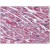 Human Heart: Formalin-Fixed, Paraffin-Embedded (FFPE)