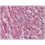 Human Heart: Formalin-Fixed, Paraffin-Embedded (FFPE)