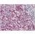 Human Spleen: Formalin-Fixed, Paraffin-Embedded (FFPE)