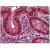 Human Colon: Formalin-Fixed, Paraffin-Embedded (FFPE)