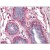 Human Breast: Formalin-Fixed, Paraffin-Embedded (FFPE)