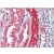 Human Kidney: Formalin-Fixed, Paraffin-Embedded (FFPE)