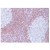 Formalin-Fixed, Paraffin-Embedded Human reactive lymph node stained with Bcl-2 antibody Cat.-No. AM10050SU-N using peroxidase conjugate and DAB chromogen. Note cytoplasmic and membrane staining of mantle B-cells cells and perifollicular T-cells and no staining of reactive B-cells in the germinal centers.