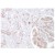 Formalin-Fixed, Paraffin-Embedded Human transplanted kidney stained with C3d antibody Cat.-No. AP10423PU-N using peroxidase conjugate and DAB chromogen. Note basement membrane staining of renal tubules and glomeruli.