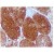 Formalin-Fixed, Paraffin-Embedded Human skeletal muscle stained with Myoglobin antibody Cat.-No. AP10436PU-N using peroxidase conjugate and DAB chromogen. Note the cytoplasmic staining of skeletal muscle fibers.
