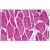 Human Skeletal Muscle: Formalin-Fixed, Paraffin-Embedded (FFPE)