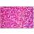 Human Liver: Formalin-Fixed, Paraffin-Embedded (FFPE)