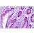 Human Colon: Formalin-Fixed, Paraffin-Embedded (FFPE)