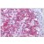 Human Tonsil: Formalin-Fixed, Paraffin-Embedded (FFPE)