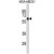 Western blot analysis of ANKRD13C Antibody (N-term) (Cat. #AP50182PU-N) in MDA-MB231 cell line lysates (35µg/lane). ANKRD13C (arrow) was detected using the purified Pab.