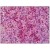 Human Spleen: Formalin-Fixed, Paraffin-Embedded (FFPE)