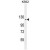 ARHGAP17 Antibody (N-term) (Cat. #AP50234PU-N) western blot analysis in K562 cell line lysates (35µg/lane).This demonstrates the ARHGAP17 antibody detected the ARHGAP17 protein (arrow).