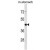 ARRDC1 Antibody (Center) (Cat. #AP50257PU-N) western blot analysis in mouse stomach tissue lysates (35µg/lane).This demonstrates the ARRDC1 antibody detected the ARRDC1 protein (arrow).