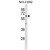 ATL1 Antibody (C-term) (Cat. #AP50288PU-N) western blot analysis in NCI-H292 cell line lysates (35µg/lane).This demonstrates the ATL1 antibody detected the ATL1 protein (arrow).