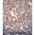 ATPBD3 antibody (Center) (Cat. #AP50309PU-N) immunohistochemistry analysis in formalin fixed and paraffin embedded human pancreas tissue followed by peroxidase conjugation of the secondary antibody and DAB staining. This data demonstrates the use of the ATPBD3 antibody (Center) for immunohistochemistry. Clinical relevance has not been evaluated.