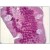 Human Small Intestine: Formalin-Fixed, Paraffin-Embedded (FFPE)