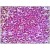 Human Spleen: Formalin-Fixed, Paraffin-Embedded (FFPE)
